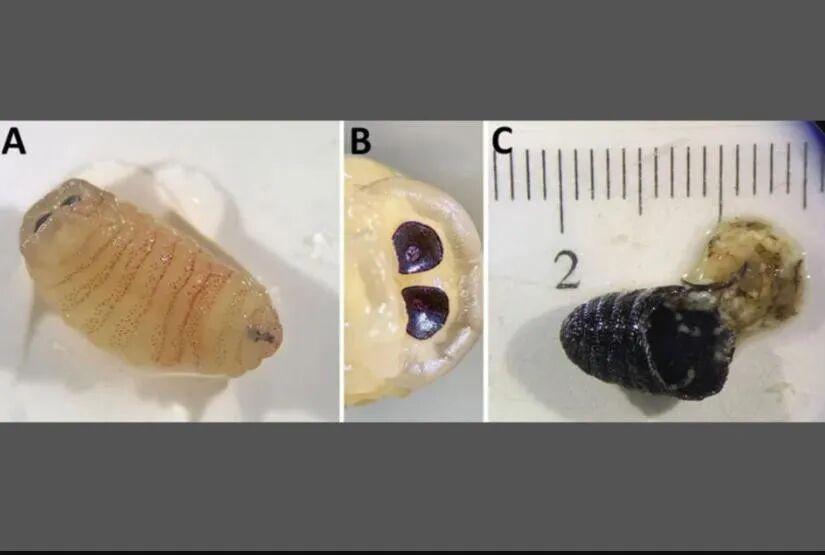  【医学前沿】人体鼻窦惊现蝇蛹：羊狂蝇跨物种寄生机理深度剖析 健康养生