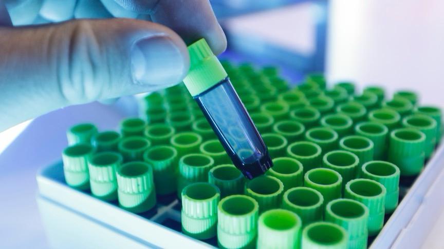  人凝血酶获批临床：派林生物子公司打开止血赛道新局面的深层逻辑 新闻 人凝血酶获批临床：派林生物子公司打开止血赛道新局面的深层逻辑 新闻 人凝血酶获批临床：派林生物子公司打开止血赛道新局面的深层逻辑 新闻 人凝血酶获批临床：派林生物子公司打开止血赛道新局面的深层逻辑 新闻 人凝血酶获批临床：派林生物子公司打开止血赛道新局面的深层逻辑 新闻 人凝血酶获批临床：派林生物子公司打开止血赛道新局面的深层逻辑 新闻